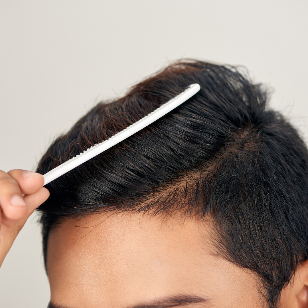 Voordelen van een haartransplantatie zonder scheren ten opzichte van traditionele methoden
